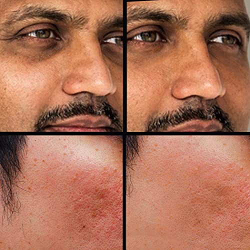 Concealer (Shade 5 of 6) X81297
