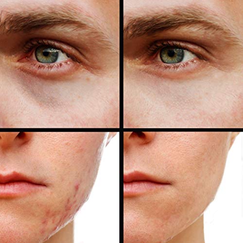 Concealer (Shade 5 of 6) X81297